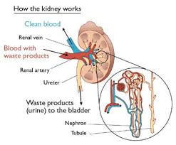 Ảnh 1 của Kidney cyst