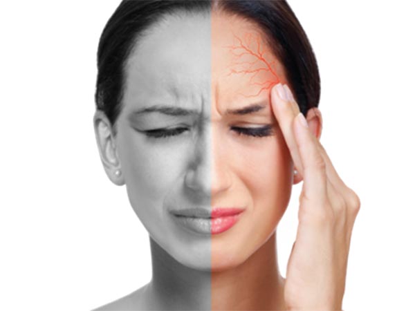 Bệnh Migraine: Nguyên nhân, biến chứng và cách điều trị