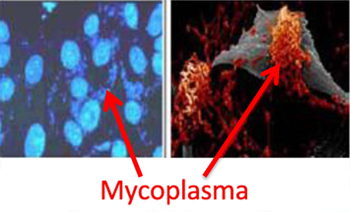 Ảnh 2 của Nhiễm khuẩn Mycoplasma