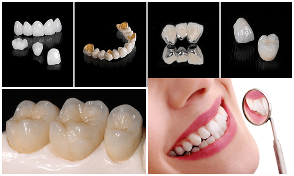 Bệnh Răng giả: Nguyên nhân, biến chứng và cách điều trị