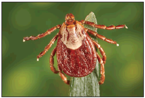 Ảnh 2 của Rocky Mountain spotted fever
