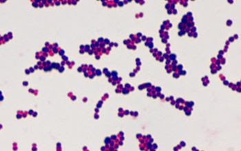 Ảnh 3 của Streptococcus