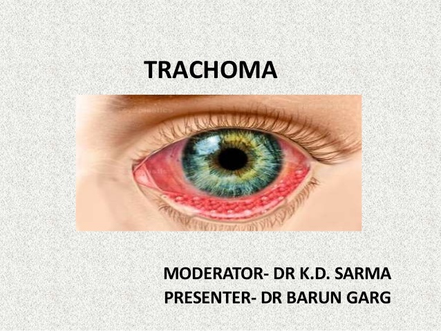 Ảnh 3 của Trachoma