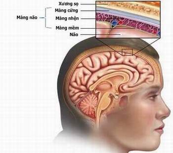 Bệnh Viêm màng não do vi khuẩn: Nguyên nhân, biến chứng và cách điều trị