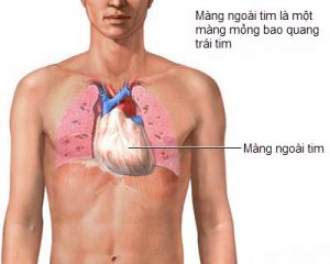 Bệnh Viêm màng ngoài tim: Nguyên nhân, biến chứng và cách điều trị