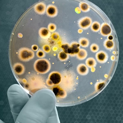 Ảnh 2 của Viêm phổi cấp do vi khuẩn Legionella