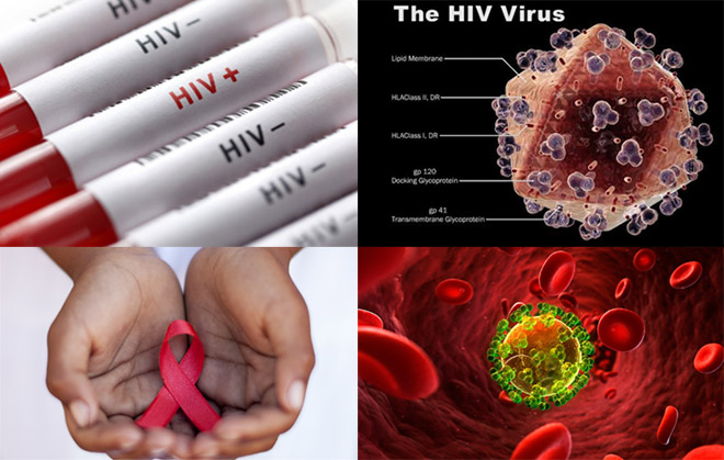 Ảnh 4 của HIV/AIDS