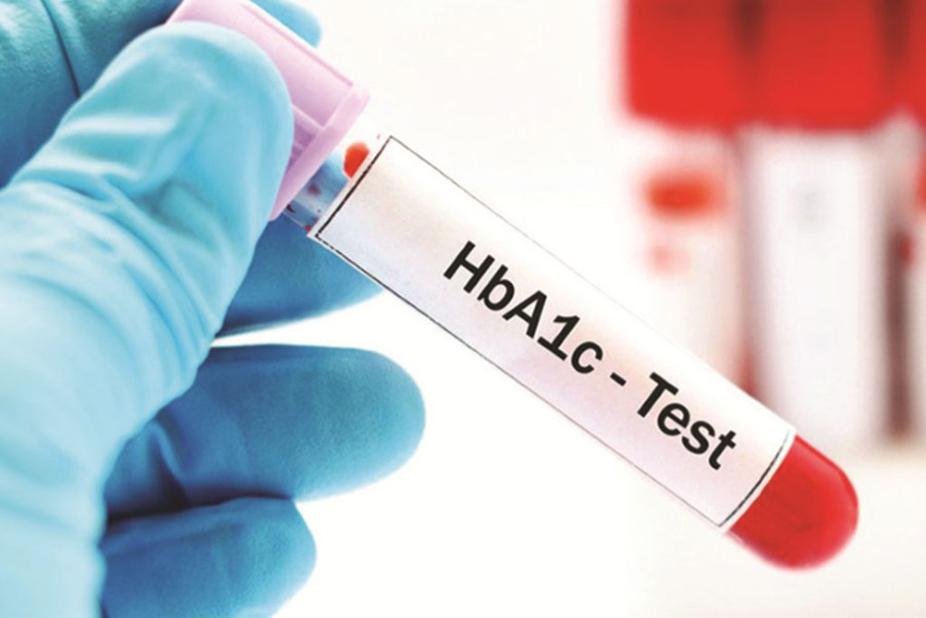 Xét nghiệm HbA1c chẩn đoán bệnh gì? và hướng dẫn đọc kết quả