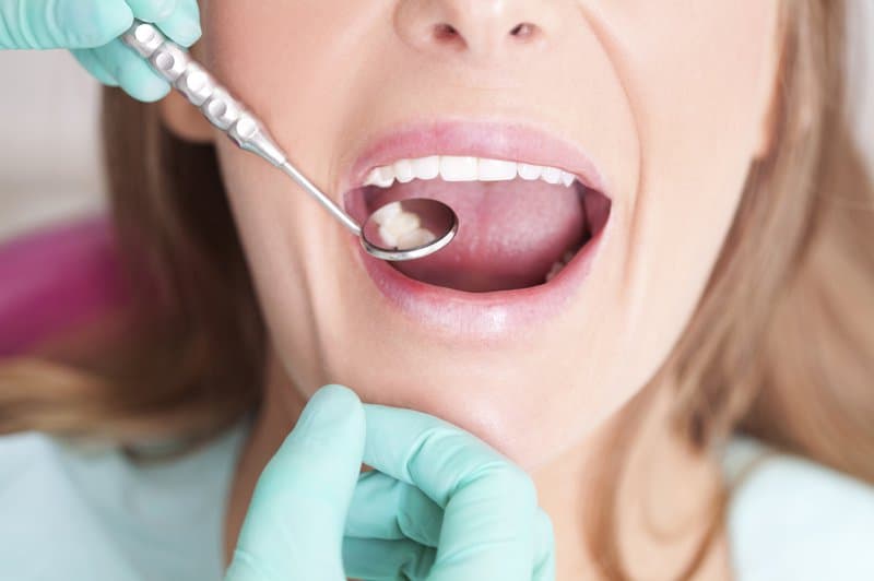 Bệnh tiểu đường ảnh hưởng đến răng miệng như thế nào?