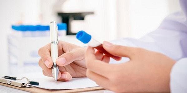 Nguyên nhân khiến chỉ số ggt tăng cao trong xét nghiệm chức năng gan?