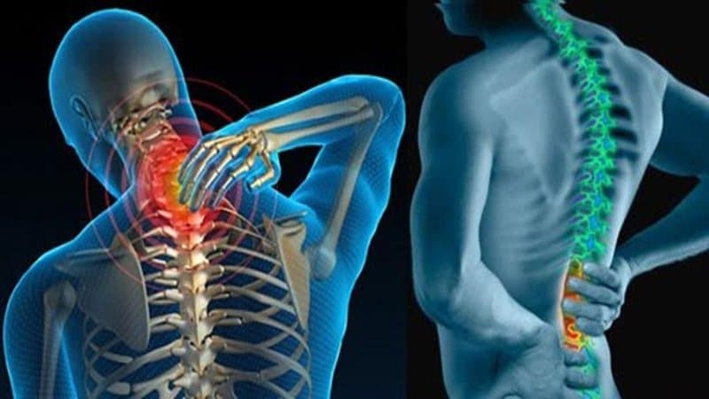 Gai cột sống là bệnh gì? có chữa được không?