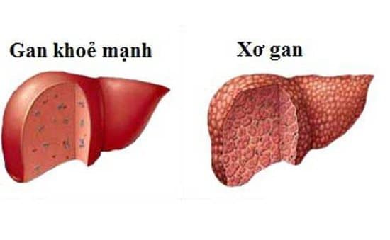 Kiểm tra chức năng gan như thế nào?