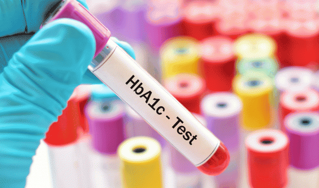 Ý nghĩa xét nghiệm HbA1c trong kiểm soát glucose ở bệnh nhân đái tháo đường