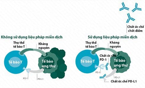 Hệ thống miễn dịch tác động tới tế bào ung thư như thế nào?