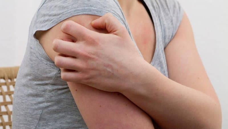 Có thể điều trị dứt điểm đau sau Zona không?
