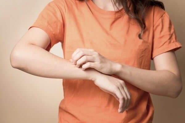 Sốt xuất huyết bị ngứa, mẩn đỏ ngoài da là bình thường hay bất thường?
