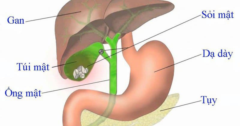 Cắt bỏ túi mật ảnh hưởng gì đến sức khoẻ?