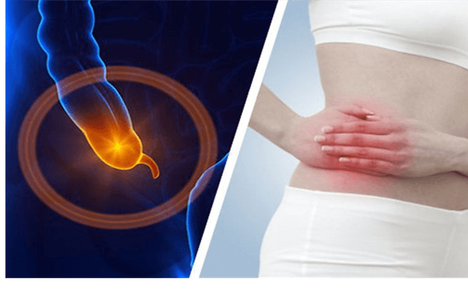 Viêm ruột thừa diễn biến thế nào và kéo dài bao lâu?