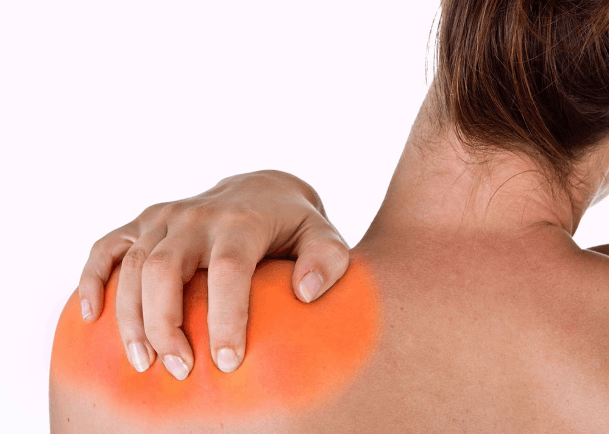 Bệnh lý khớp vai thường gặp