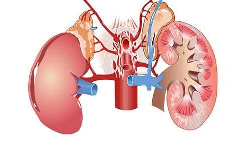 Triệu chứng của suy thận mạn thường âm thầm, không rõ ràng