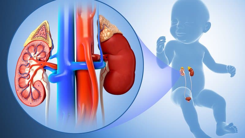Viêm cầu thận cấp ở trẻ em là bệnh gì/ và Cách điều trị