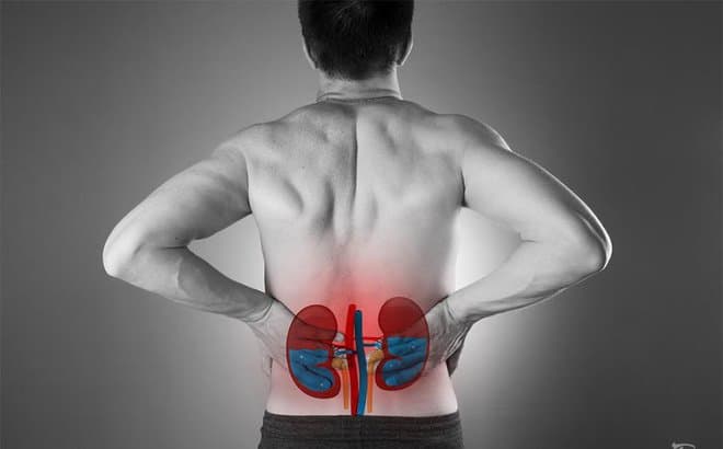 Thận ứ nước - Chẩn đoán và điều trị