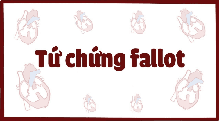 Tứ chứng Fallot là bệnh gì? có Triệu chứng như thế nào?
