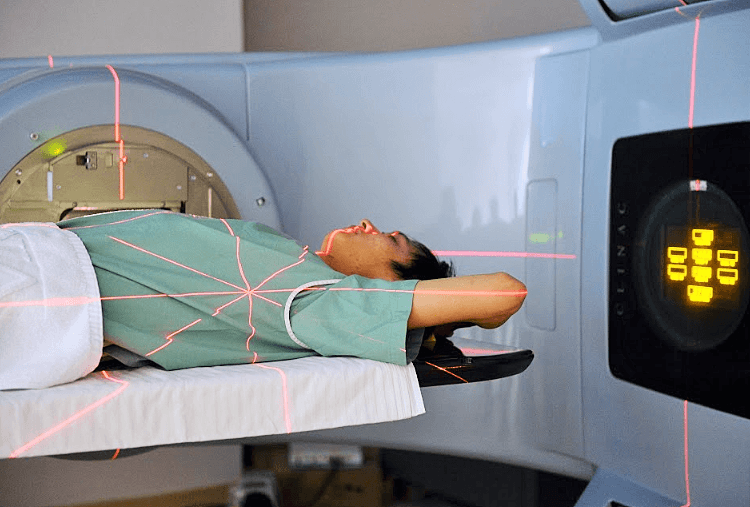 Các tác dụng phụ khi Xạ trị bệnh nhân ưng thư cần biết