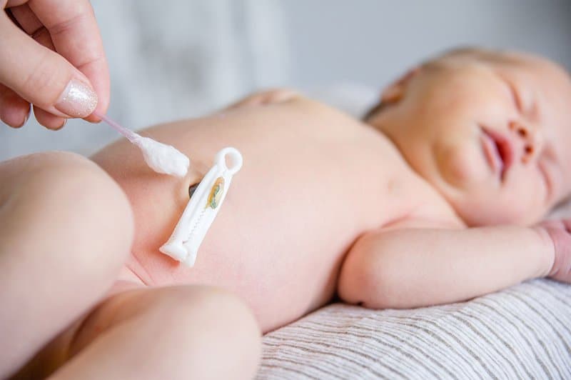 Hướng dẫn Cách chăm sóc rốn cho trẻ sơ sinh