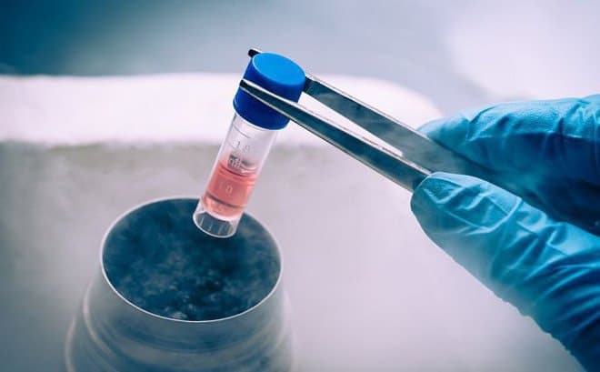 Sau khi ghép tế bào gốc có những tác dụng phụ gì có thể gặp sảy ra