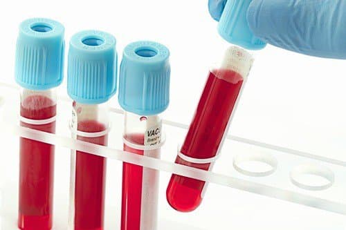 Ý nghĩa Xét nghiệm HBcAb trong chẩn đoán viêm gan B