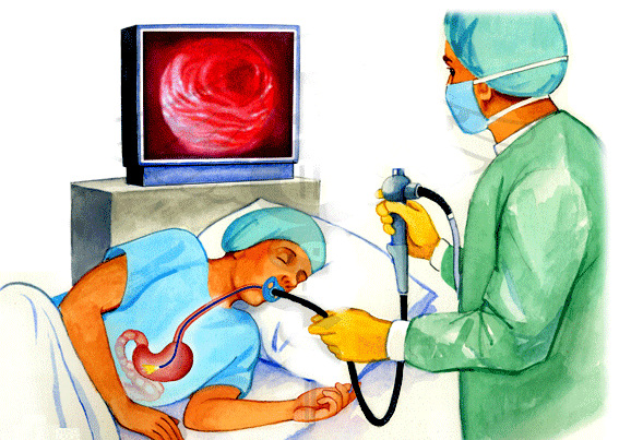 Nội soi dạ dày thực quản cấp cứu chảy máu tiêu hóa cao để chẩn đoán và điều trị