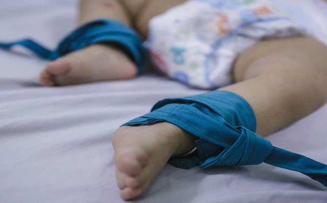 Điều trị bệnh tay chân miệng độ 3 theo hướng dẫn của Bộ Y tế