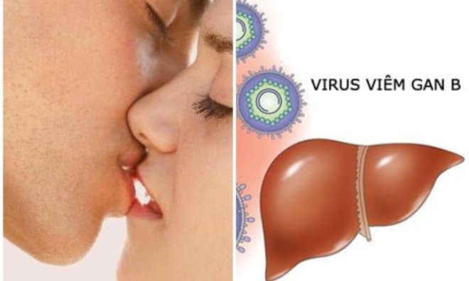 Quan hệ tình dục qua đường miệng có khả năng lây nhiễm virus viêm gan B