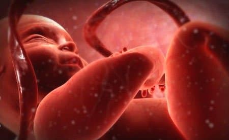 Bệnh giang mai bẩm sinh những điều cần biết