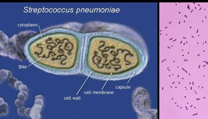 Phế cầu khuẩn S.pneumoniae gây ra các bệnh lý gì? Và Cách phòng ngừa như thế nào?