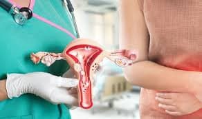 Viêm âm đạo do Trichomoniasis: Những điều cần biết