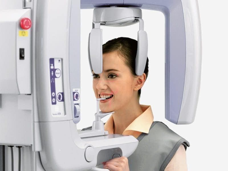 Chụp X quang răng toàn cảnh những điều cần biết