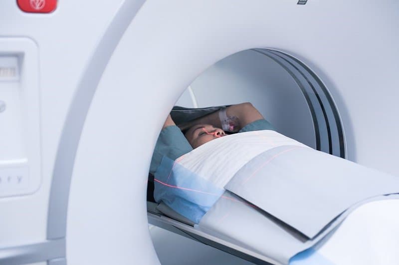 Chụp cộng hưởng từ khuếch tán (DWI-Diffusion-weighted Imaging)