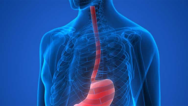 Cắt thực quản, tạo hình thực quản bằng đại tràng không mở ngực