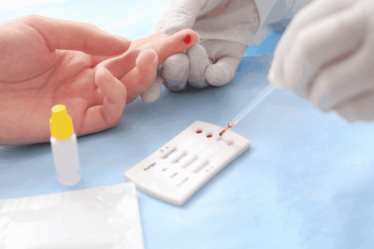 Xét nghiệm giang mai những điều cần biết
