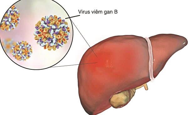 Những điều cần biết khi sử dụng thuốc kháng virus viêm gan B