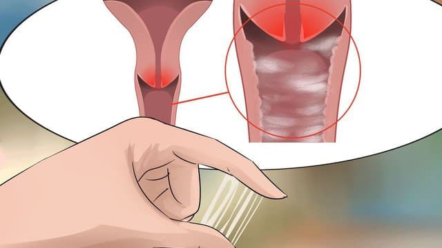 Phân biệt và Cách phòng tránh viêm âm đạo, viêm niệu đạo