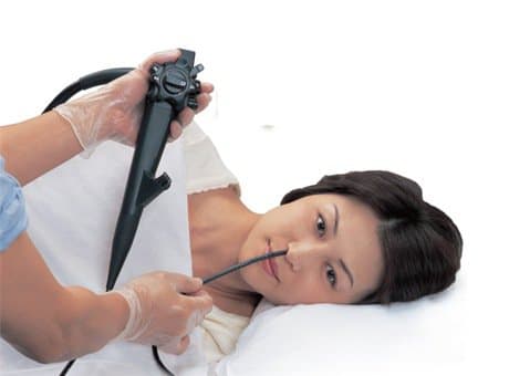 Ưu điểm của nội soi tiêu hóa qua đường mũi