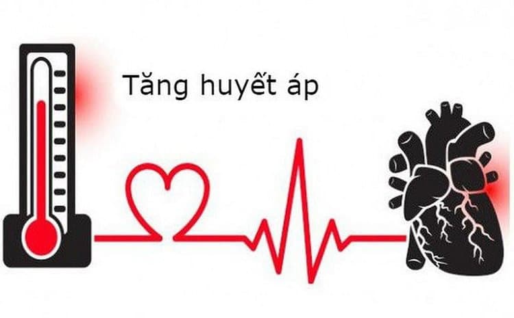 Nguyên nhân tăng huyết áp nặng phải cấp cứu