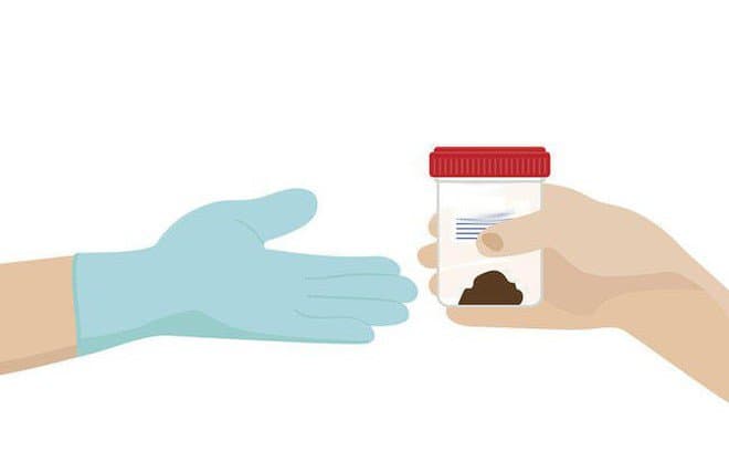 Xét nghiệm Calprotectin là gì? Ý nghĩa các chỉ số xét nghiệm Calprotectin