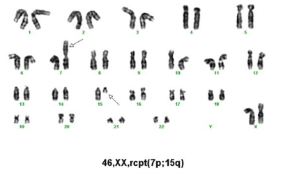 Karyotype Test là gì? Ứng dụng trong điều trị hiếm muộn