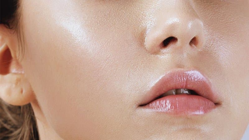 Nguyên nhân gây da dầu và Cách chăm sóc tại nhà
