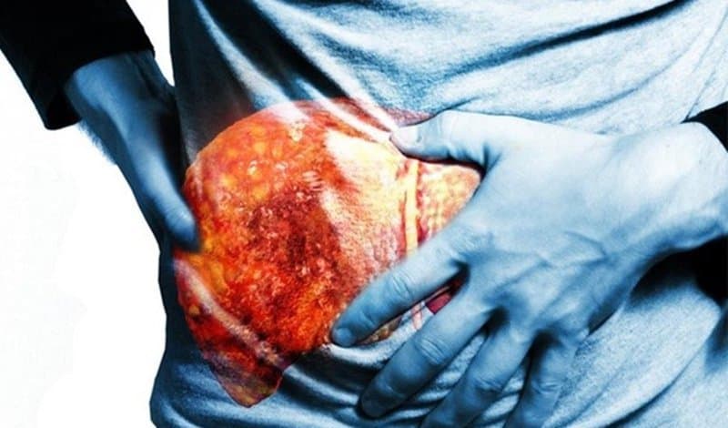 Vai trò của cộng hưởng từ đàn hồi (MRE) trong đánh giá xơ gan