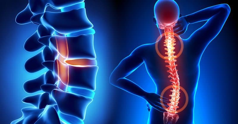 Quy trình chụp cộng hưởng từ cột sống ngực không tiêm thuốc đối quang từ